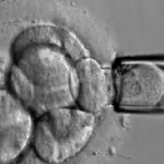 Come evitare l'aborto spontaneo? Rischi, fasi, analisi, verifiche, sintomi