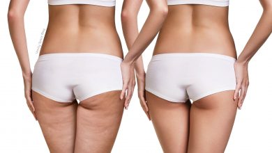 7 modi per combattere la cellulite in modo naturale